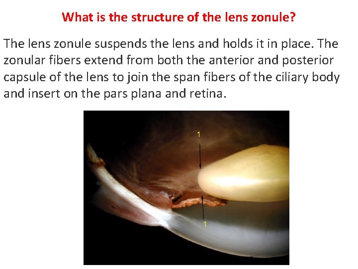 What is the structure of the lens zonule? The lens zonule suspends the lens