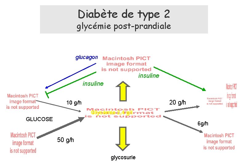 Diabète de type 2 glycémie post-prandiale glucagon insuline 20 g/h 10 g/h Glycémie 2,