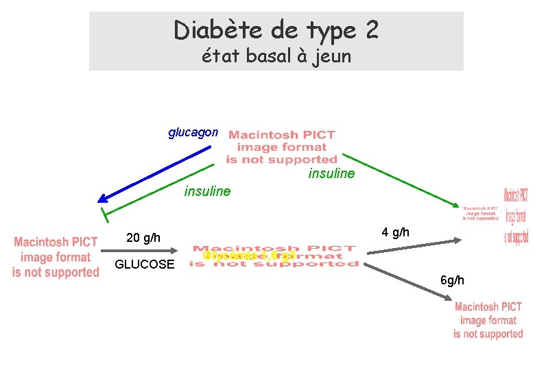 Diabète de type 2 état basal à jeun glucagon insuline 4 g/h 20 g/h