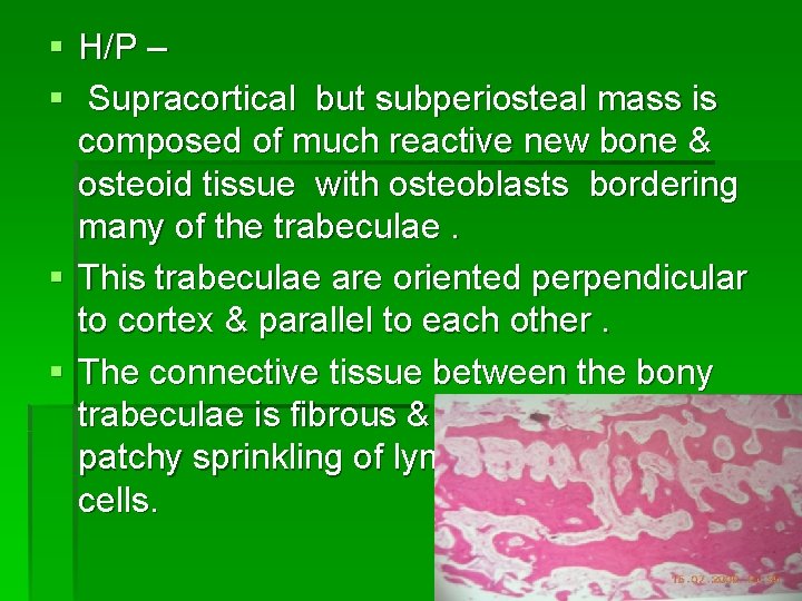 § H/P – § Supracortical but subperiosteal mass is composed of much reactive new