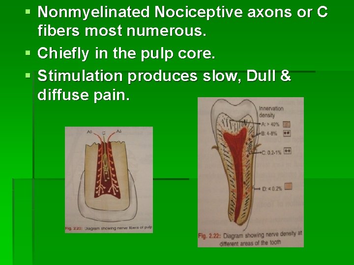 § Nonmyelinated Nociceptive axons or C fibers most numerous. § Chiefly in the pulp