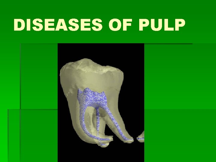 DISEASES OF PULP 