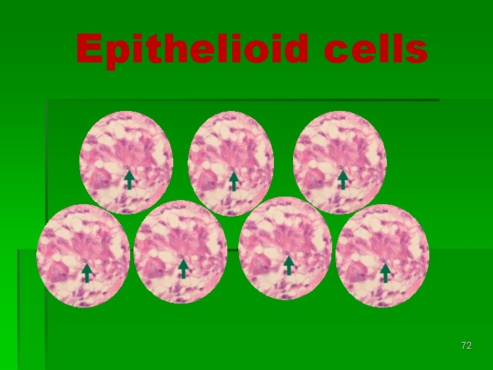 Epithelioid cells 72 