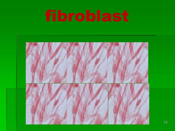fibroblast 74 