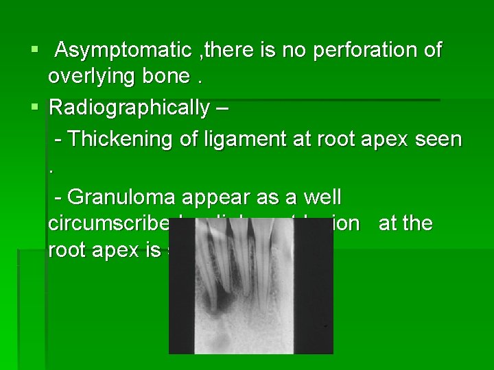 § Asymptomatic , there is no perforation of overlying bone. § Radiographically – -