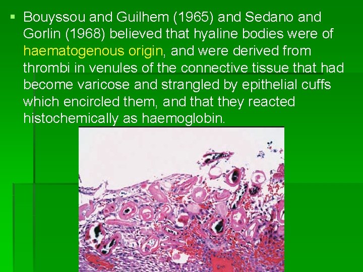 § Bouyssou and Guilhem (1965) and Sedano and Gorlin (1968) believed that hyaline bodies