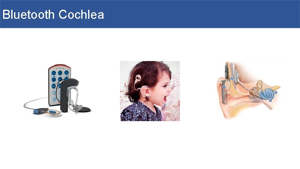 Bluetooth Cochlea 