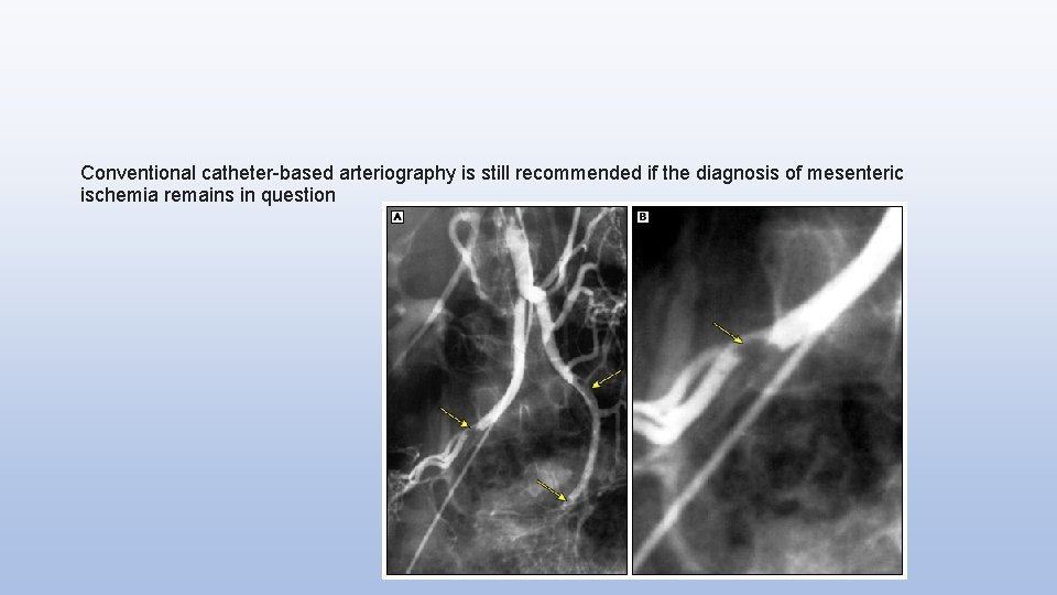 Conventional catheter-based arteriography is still recommended if the diagnosis of mesenteric ischemia remains in