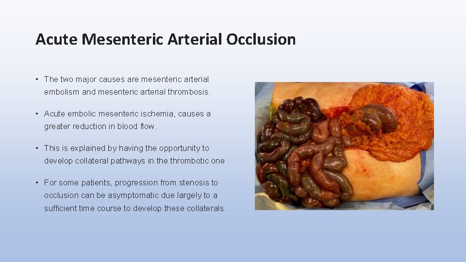 Acute Mesenteric Arterial Occlusion • The two major causes are mesenteric arterial embolism and