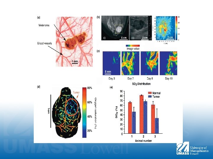 PHOTOACOUSTIC IMAGING TO DETECT TUMOR HAIFENG WANG SUBHASHINI