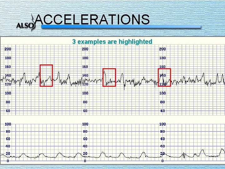 ACCELERATIONS 3 examples are highlighted 