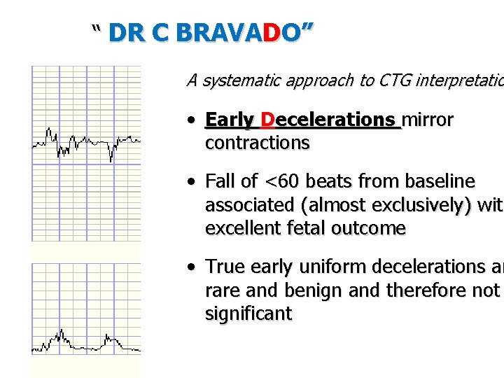 “ DR C BRAVADO” A systematic approach to CTG interpretatio • Early Decelerations mirror