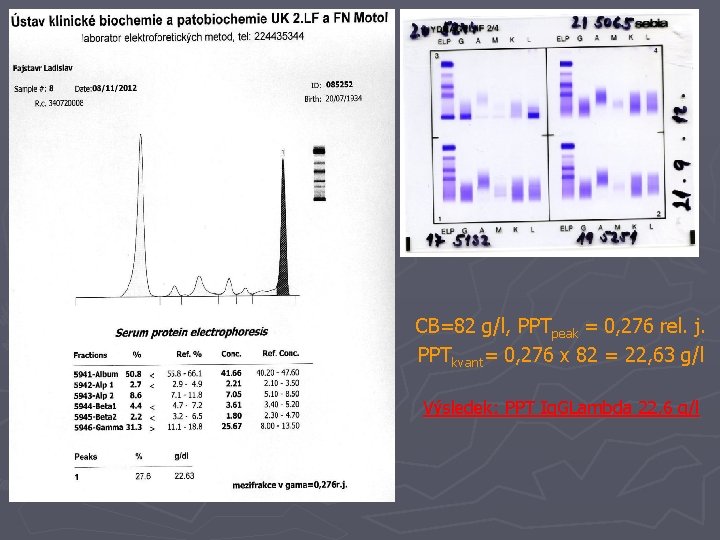 CB=82 g/l, PPTpeak = 0, 276 rel. j. PPTkvant= 0, 276 x 82 =