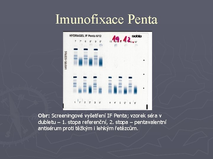 Imunofixace Penta Obr: Screeningové vyšetření IF Penta; vzorek séra v dubletu – 1. stopa