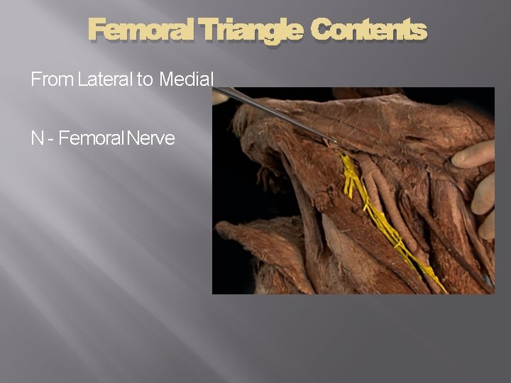 Femoral Triangle Contents From Lateral to Medial N - Femoral Nerve 