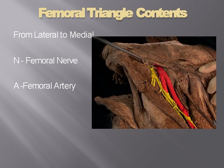 Femoral Triangle Contents From Lateral to Medial N - Femoral Nerve A -Femoral Artery