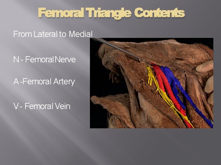 Femoral Triangle Contents From Lateral to Medial N - Femoral Nerve A -Femoral Artery