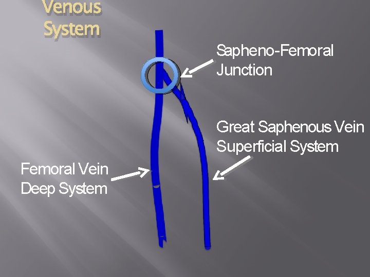 Venous System Sapheno-Femoral Junction Great Saphenous Vein Superficial System Femoral Vein Deep System 