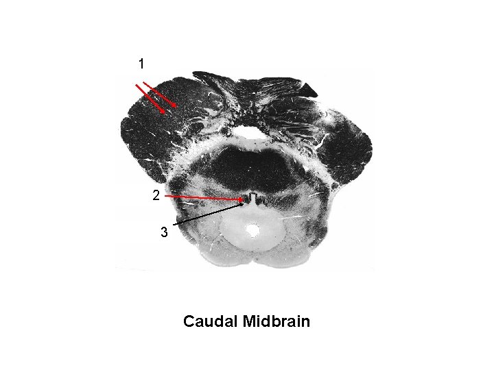descending 1 fibers cortical 2 MLF Trochlear nucleus 3 Caudal Midbrain 