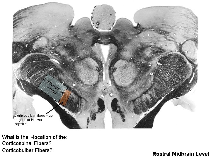 Co rtic Fib osp er ina l s Corticobulbar fibers – go to genu