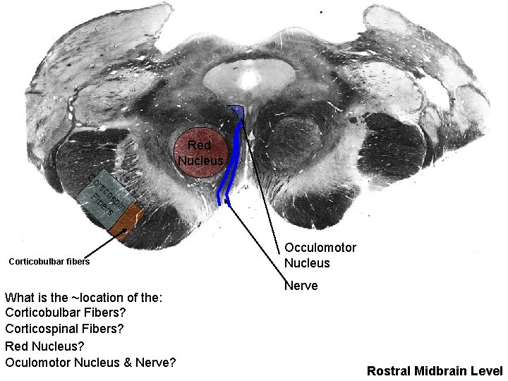 Red Nucleus C or tic Fi os be pi rs na l Corticobulbar fibers