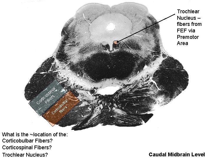 Trochlear Nucleus – fibers from FEF via Premotor Area al n i sp s