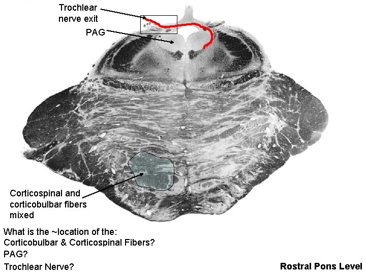 Trochlear nerve exit PAG Corticospinal and corticobulbar fibers mixed What is the ~location of