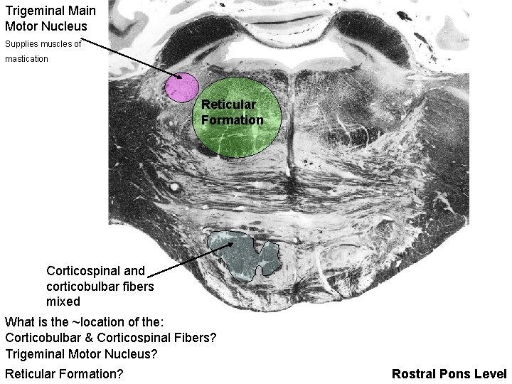 Trigeminal Main Motor Nucleus Supplies muscles of mastication Reticular Formation Corticospinal and corticobulbar fibers