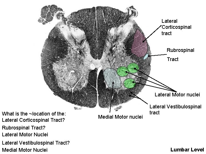 Lateral Corticospinal tract Rubrospinal Tract Lateral Motor nuclei What is the ~location of the:
