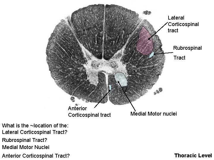 Lateral Corticospinal tract Rubrospinal Tract Anterior Corticospinal tract Medial Motor nuclei What is the