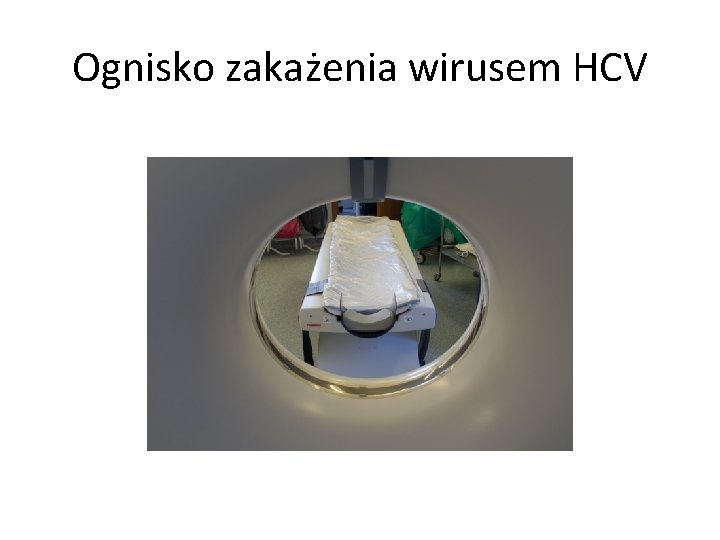 Ognisko zakażenia wirusem HCV 