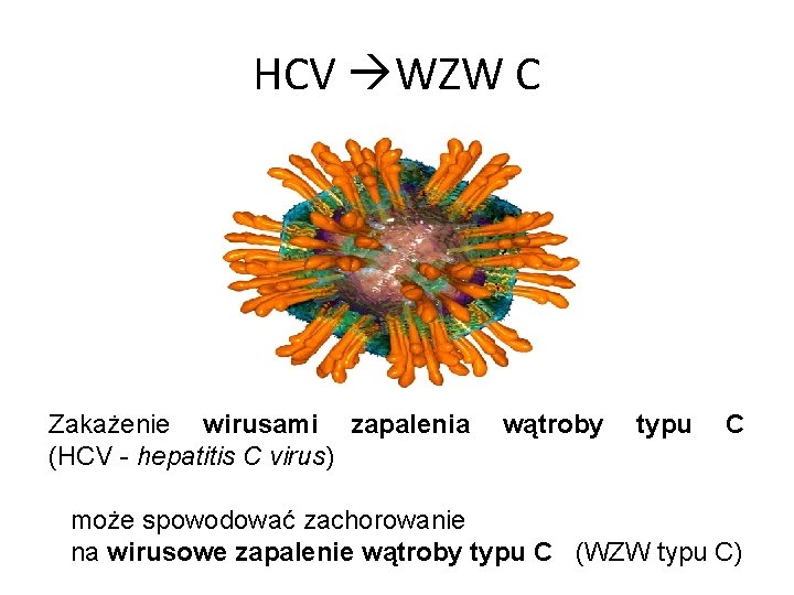 HCV WZW C Zakażenie wirusami zapalenia (HCV - hepatitis C virus) wątroby typu C