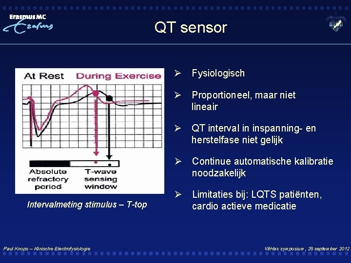 QT sensor Ø Fysiologisch Ø Proportioneel, maar niet lineair Ø QT interval in inspanning-