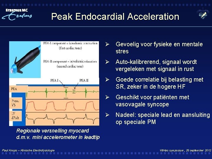 Peak Endocardial Acceleration Ø Gevoelig voor fysieke en mentale stres Ø Auto-kalibrerend, signaal wordt