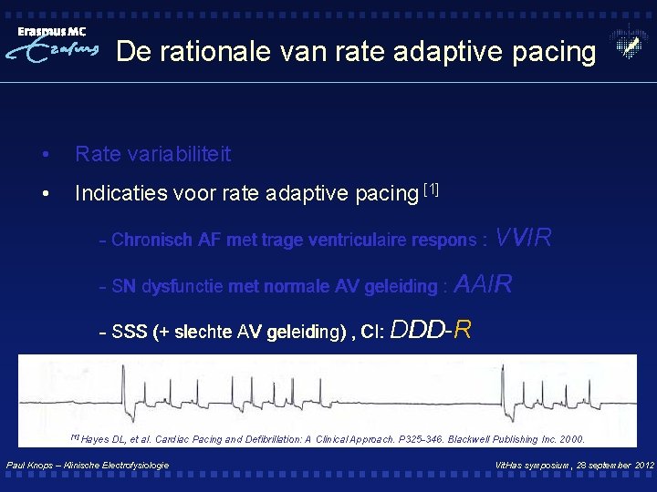 De rationale van rate adaptive pacing • Rate variabiliteit • Indicaties voor rate adaptive