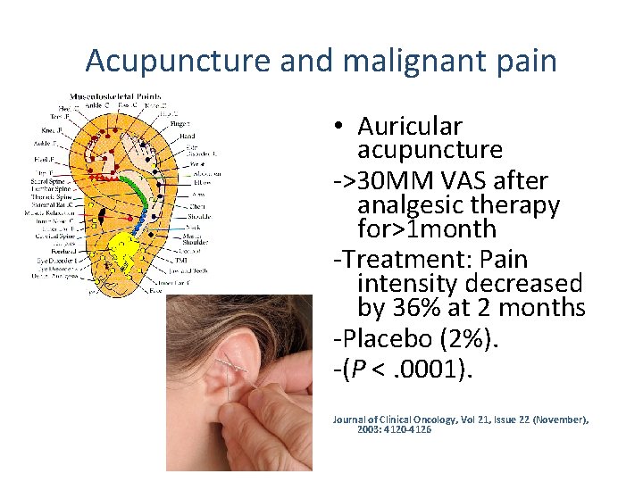 Acupuncture and malignant pain • Auricular acupuncture ->30 MM VAS after analgesic therapy for>1