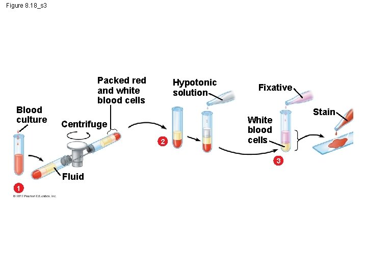 Figure 8. 18_s 3 Blood culture Packed red and white blood cells Hypotonic solution