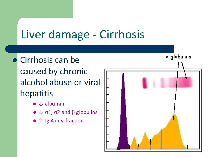 Liver damage - Cirrhosis l Cirrhosis can be caused by chronic alcohol abuse or