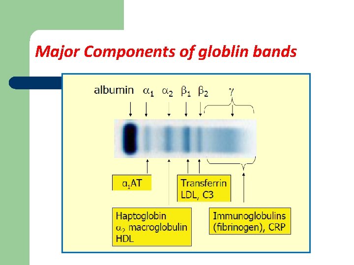 Major Components of globlin bands 