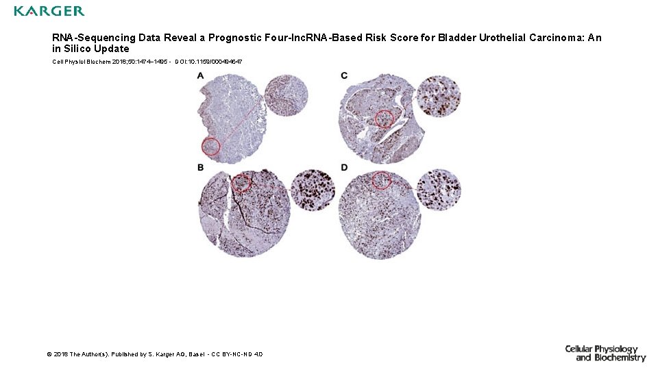 RNA-Sequencing Data Reveal a Prognostic Four-lnc. RNA-Based Risk Score for Bladder Urothelial Carcinoma: An