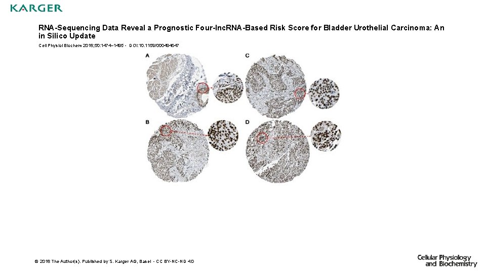 RNA-Sequencing Data Reveal a Prognostic Four-lnc. RNA-Based Risk Score for Bladder Urothelial Carcinoma: An