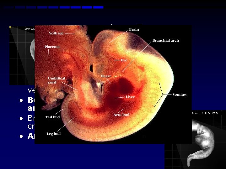 Week 4 -5 • Beginning of vertebra and bones • Development of the heart