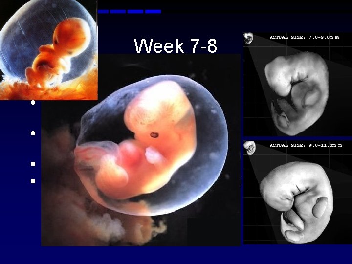 Week 7 -8 • Nipples and hair follicles form • Elbows and toes visible