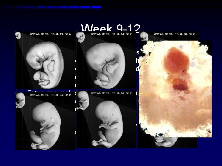 Week 9 -12 • • • Fetus reaches a length of 3. 2 inches