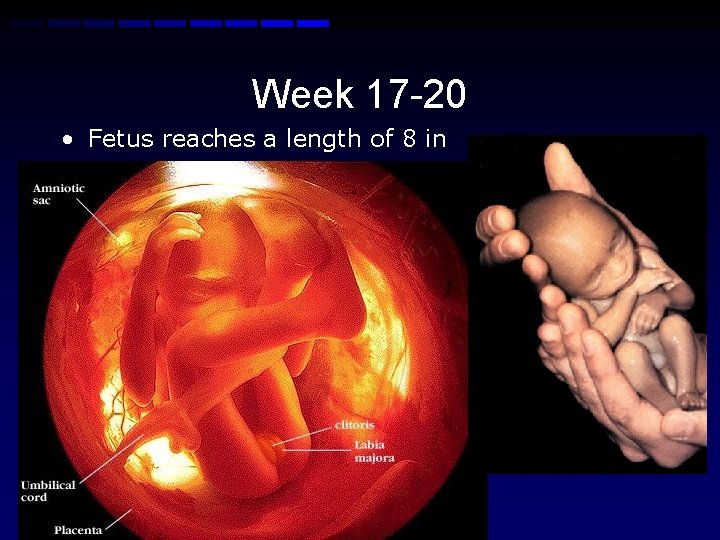 Week 17 -20 • Fetus reaches a length of 8 in • Lanugo hair
