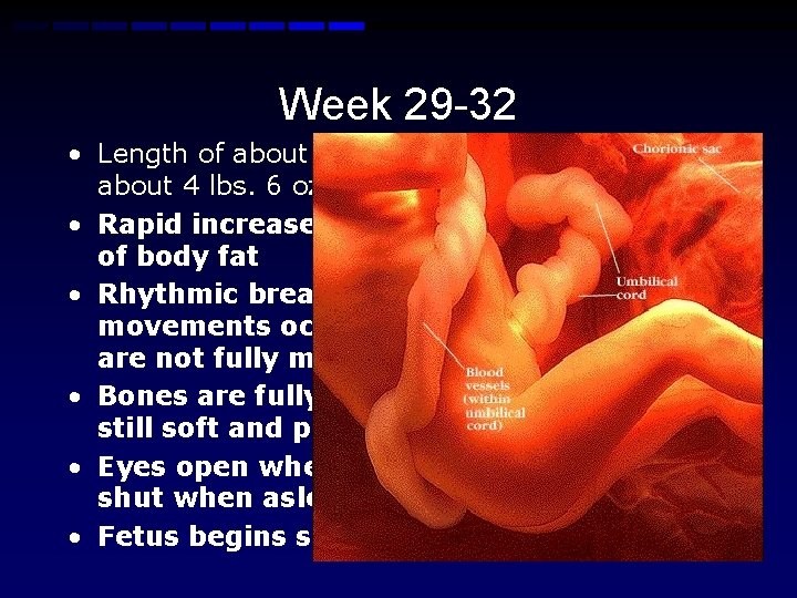 Week 29 -32 • Length of about 15 -17 inchesabout 4 lbs. 6 oz.