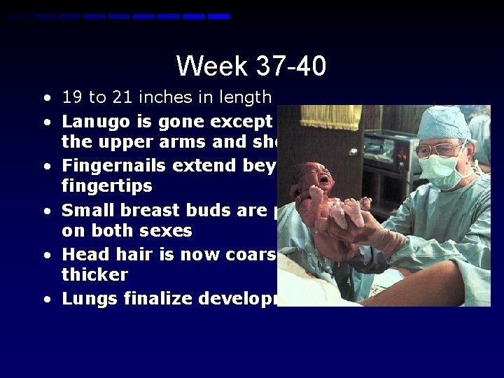 Week 37 -40 • 19 to 21 inches in length • Lanugo is gone