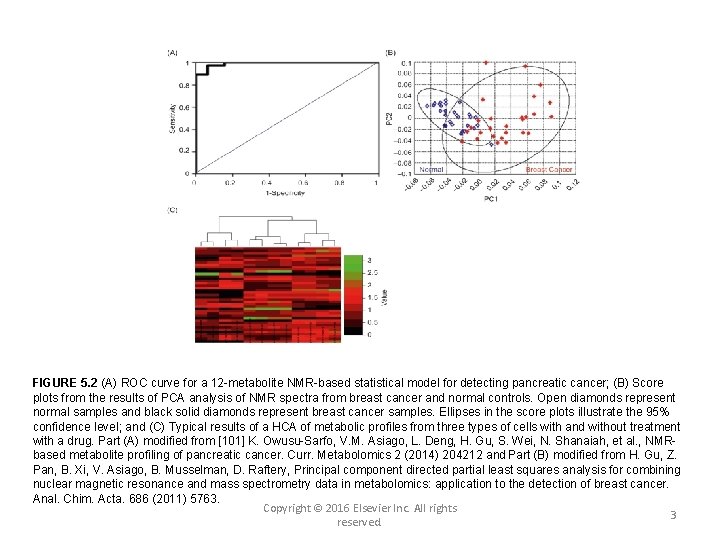 FIGURE 5. 2 (A) ROC curve for a 12 -metabolite NMR-based statistical model for