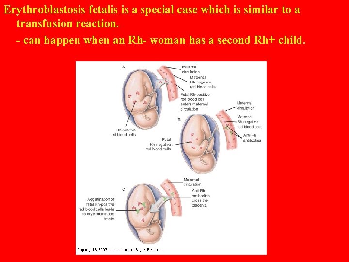 Erythroblastosis fetalis is a special case which is similar to a transfusion reaction. -