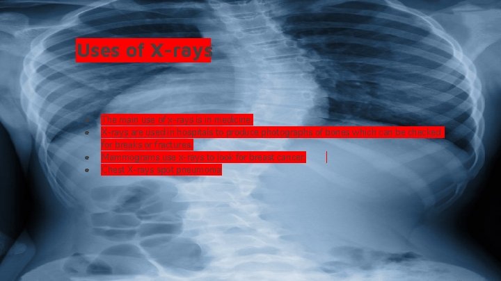 Uses of X-rays ● ● The main use of x-rays is in medicine. X-rays